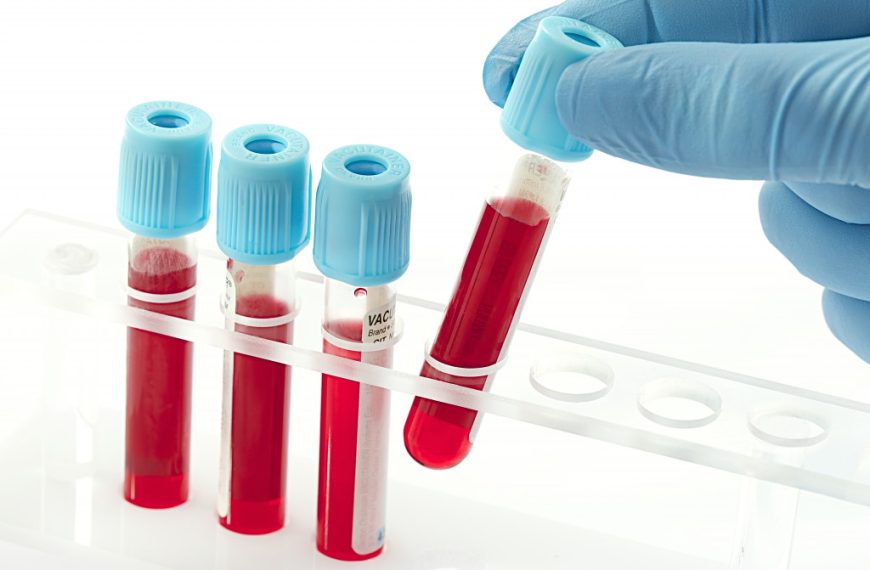 Blood samples in tubes